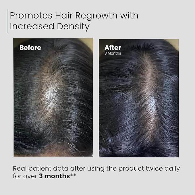 Anable Hair Serum 50 ml